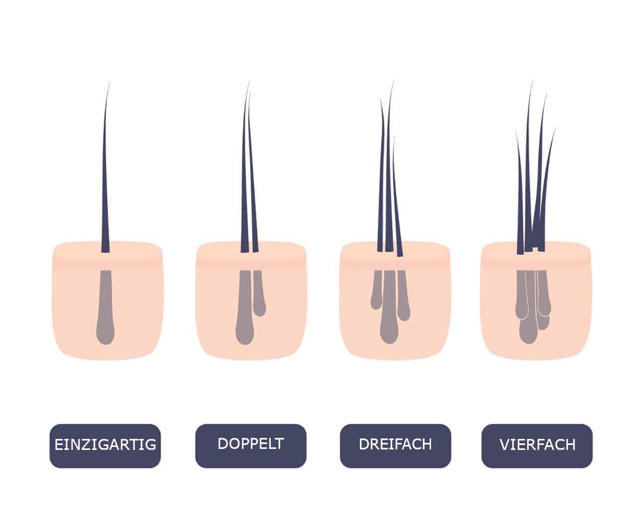 grafts haatransplant 1